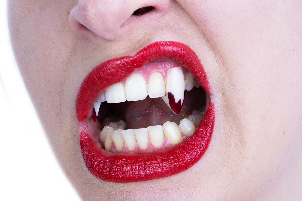 Scarecrow Blood Tipped Deluxe Vampire Fangs - Custom Fit, Realistic, Reusable - Image 2